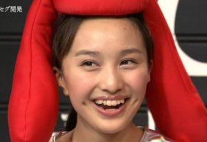 百田夏菜子がかわいい八重歯を歯科矯正したリアルな３つの理由 Makealife